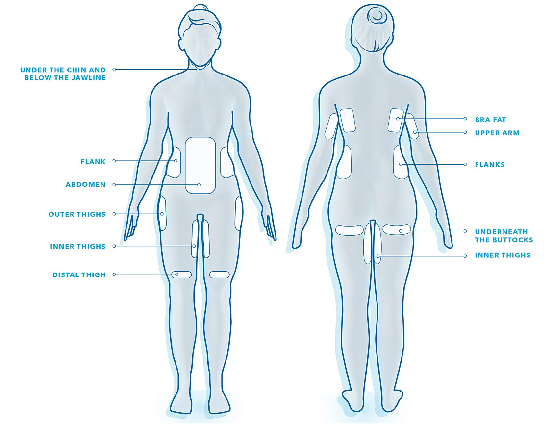 Body areas for cosmetic treatment reference guide.