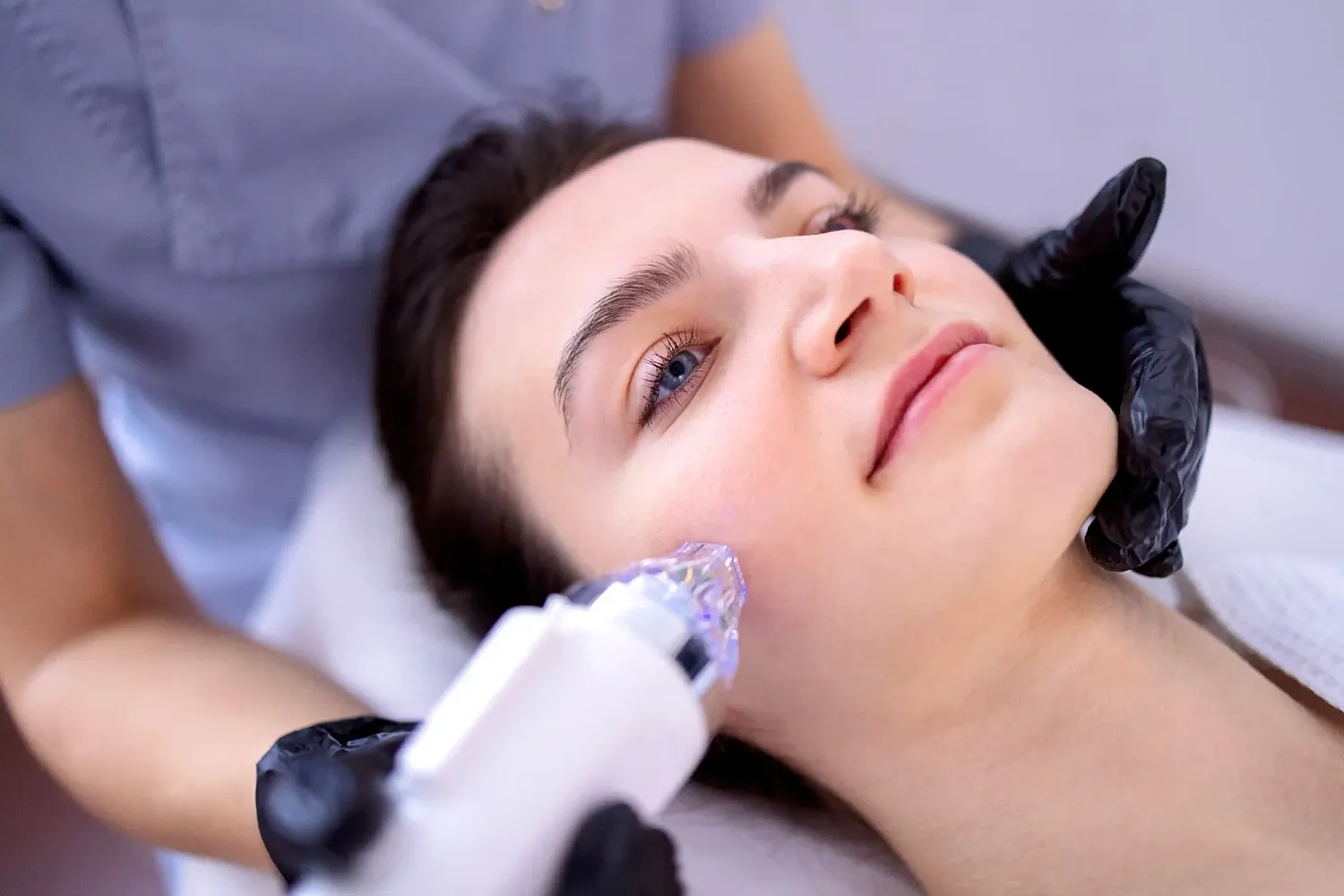 How Long Do RF Microneedling Results Last?