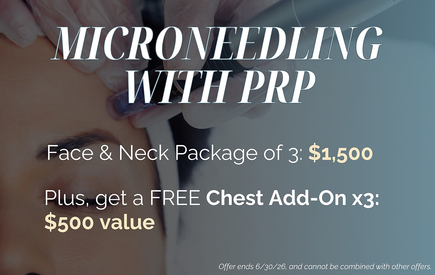 Microneedling with PRP promotional offer details