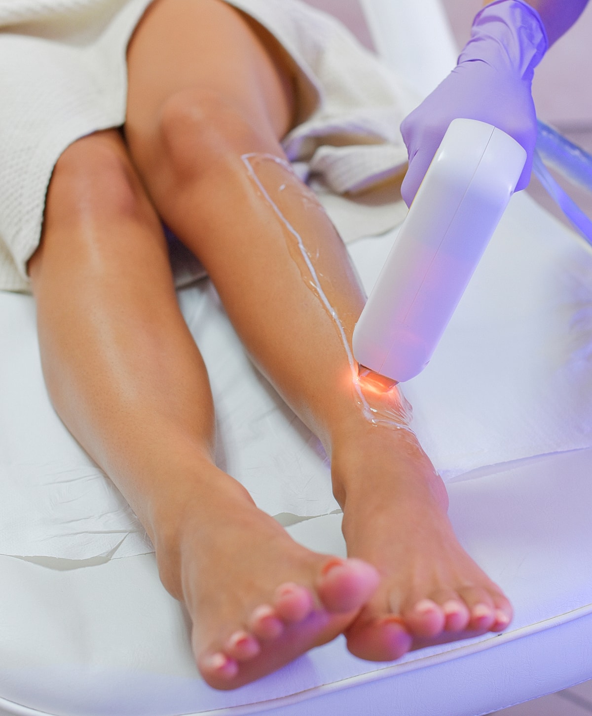 Laser hair removal treatment on legs.