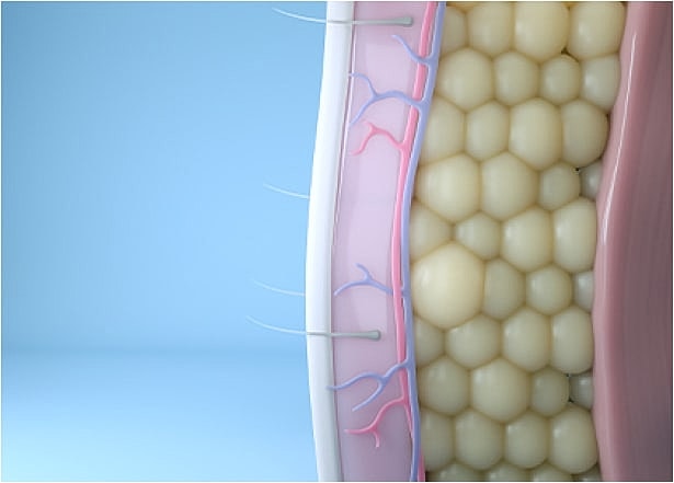 Illustration of reduced fat cells under the skin after CoolSculpting