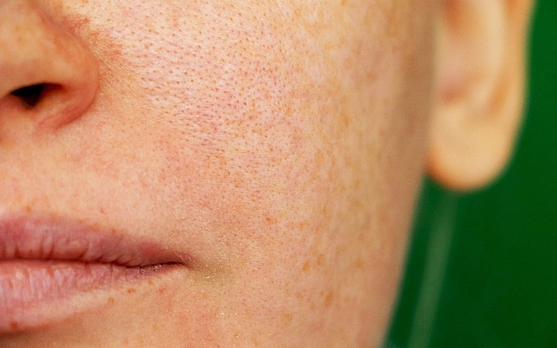 Close-up of textured skin and lips.
