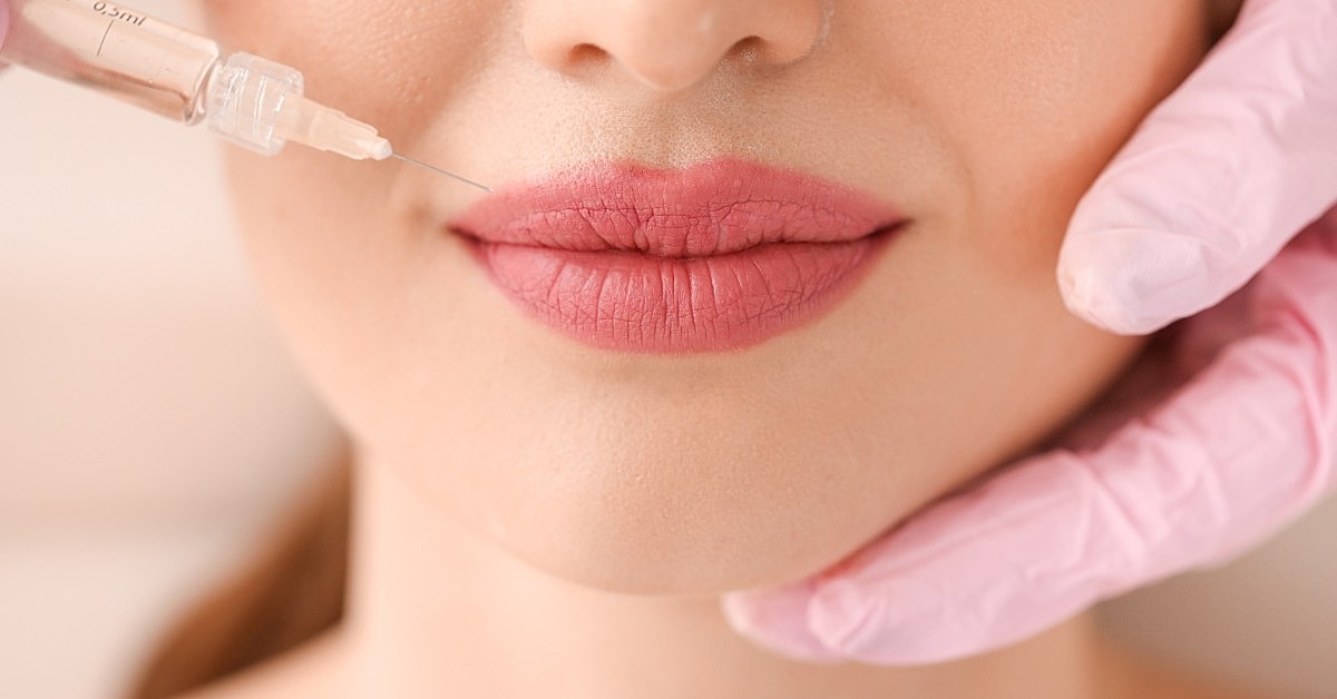 Lip filler injection procedure in a beauty treatment.