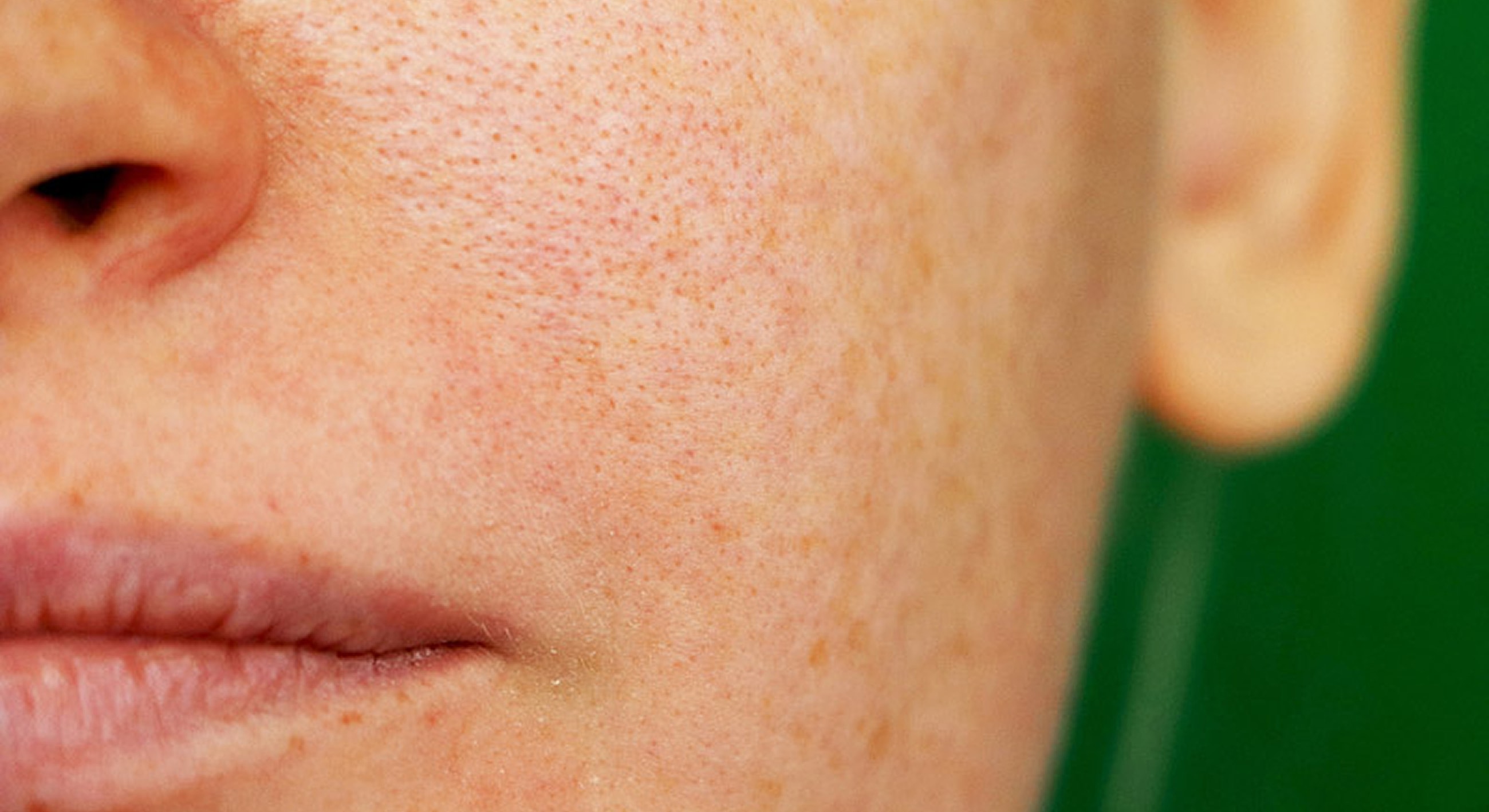 Close-up of smooth skin texture.