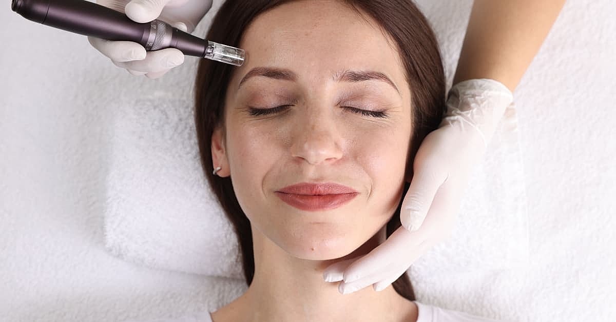 Woman receiving facial treatment with microneedling device.