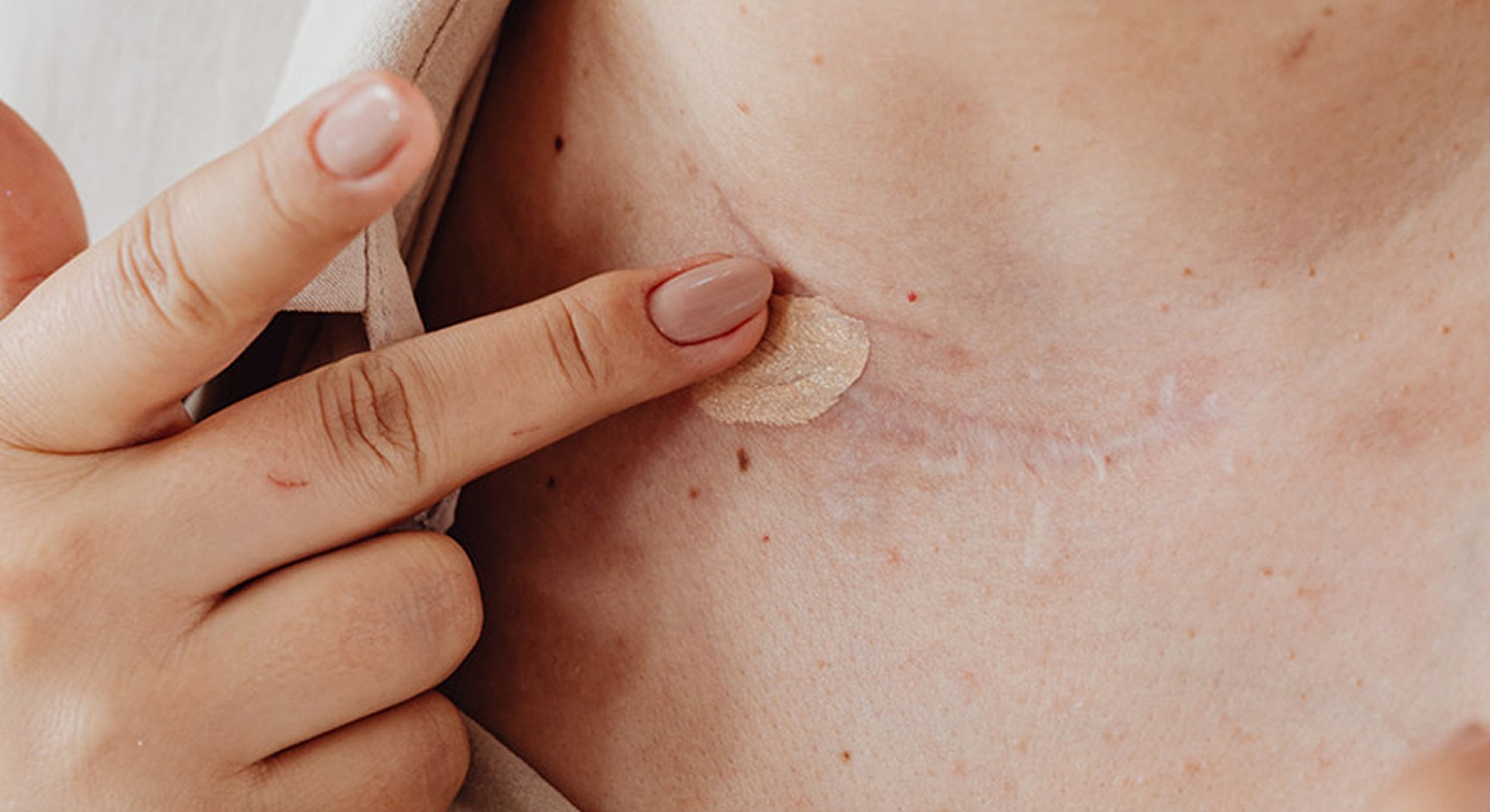 Applying adhesive patch on skin near collarbone.