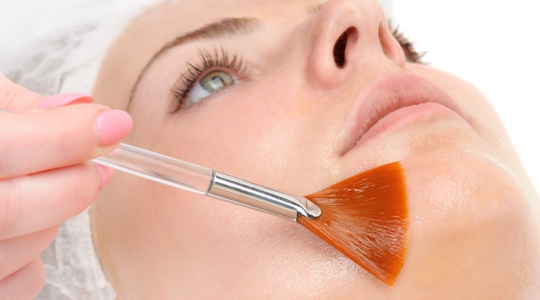 Woman receiving a chemical peel at a medspa