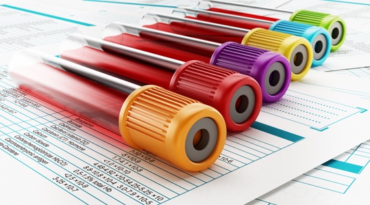 Vials of blood for labwork and diagnostic testing