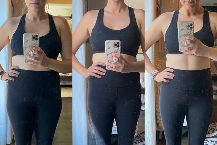 Before and After CoolSculpting Treatment at Ageless Remedies (Front)