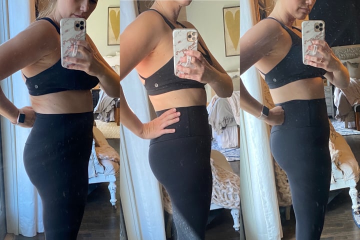 Before and After CoolSculpting Treatment at Ageless Remedies (Right Side)