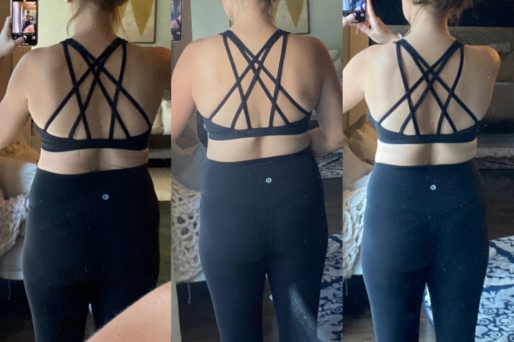 Before and After CoolSculpting Treatment at Ageless Remedies (Back)