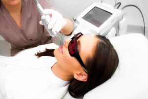 A woman receiving Facial Laser Resurfacing treatment, as described in the Facial Laser Resurfacing Guide at Ageless Remedies of Roswell.