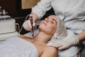 A woman receives an RF microneedling treatment on her décolletage at a spa, where an aesthetician uses a specialized device to stimulate collagen production and improve skin texture.